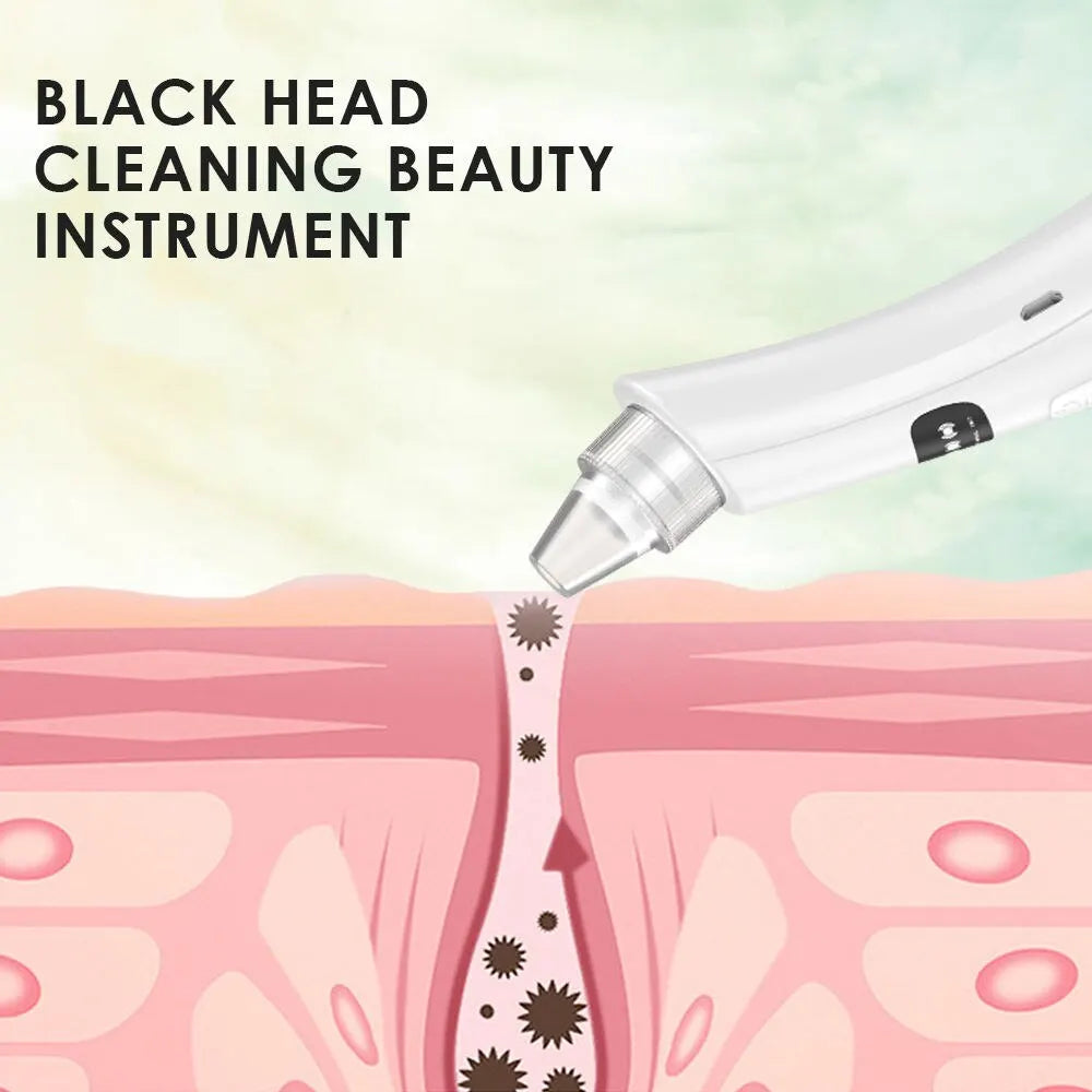 3-Mode Blackhead Vacuum & Pore Cleansing Device – Blackhead Remover UK