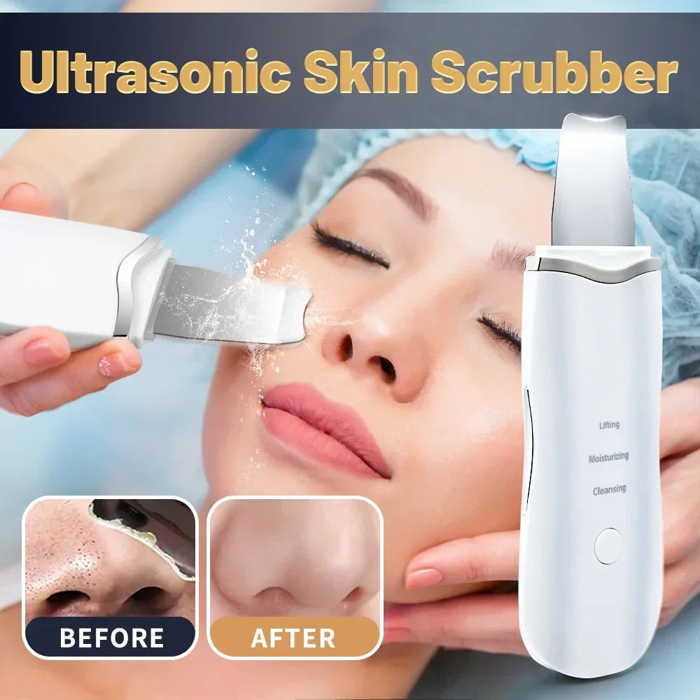 Ultrasonic Facial Skin Scrubber – Ion Deep Cleansing & Exfoliation Device UK