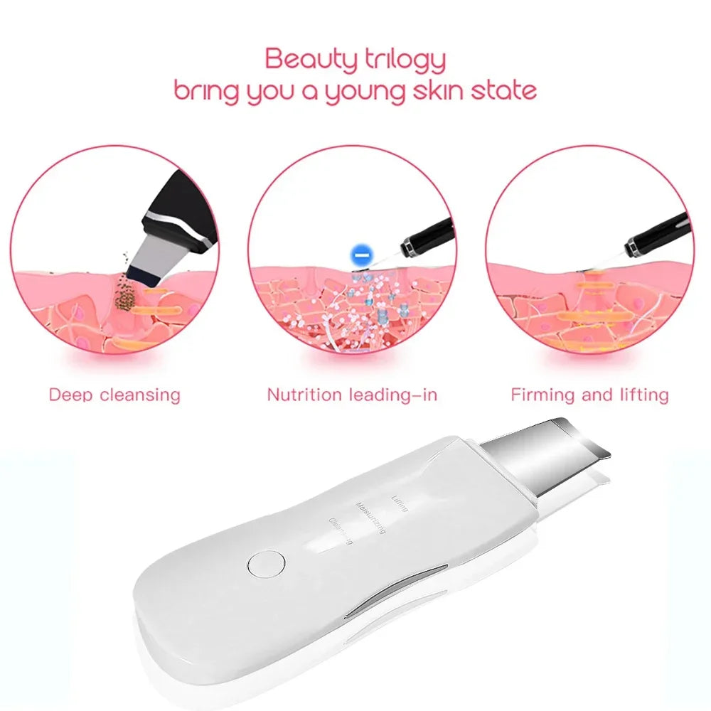 Ultrasonic Facial Skin Scrubber – Ion Deep Cleansing & Exfoliation Device UK